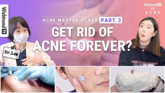 All About Acne Care: From Acne Laser Treatment to Medication | 4-Week Acne Master Course | Part 3